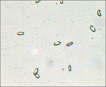Funghi... e la mia prima micro!